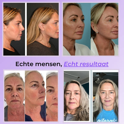 Dermalift | Herontdek Je Stralende Huid