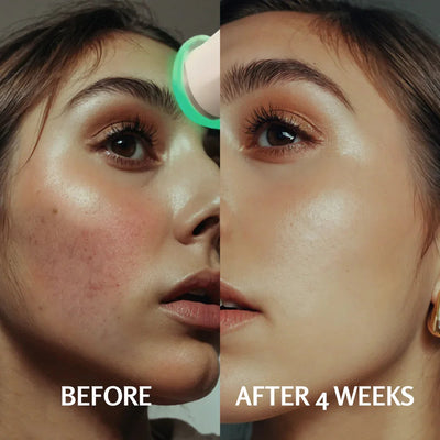 PureRise | Luxe Huidverjonging