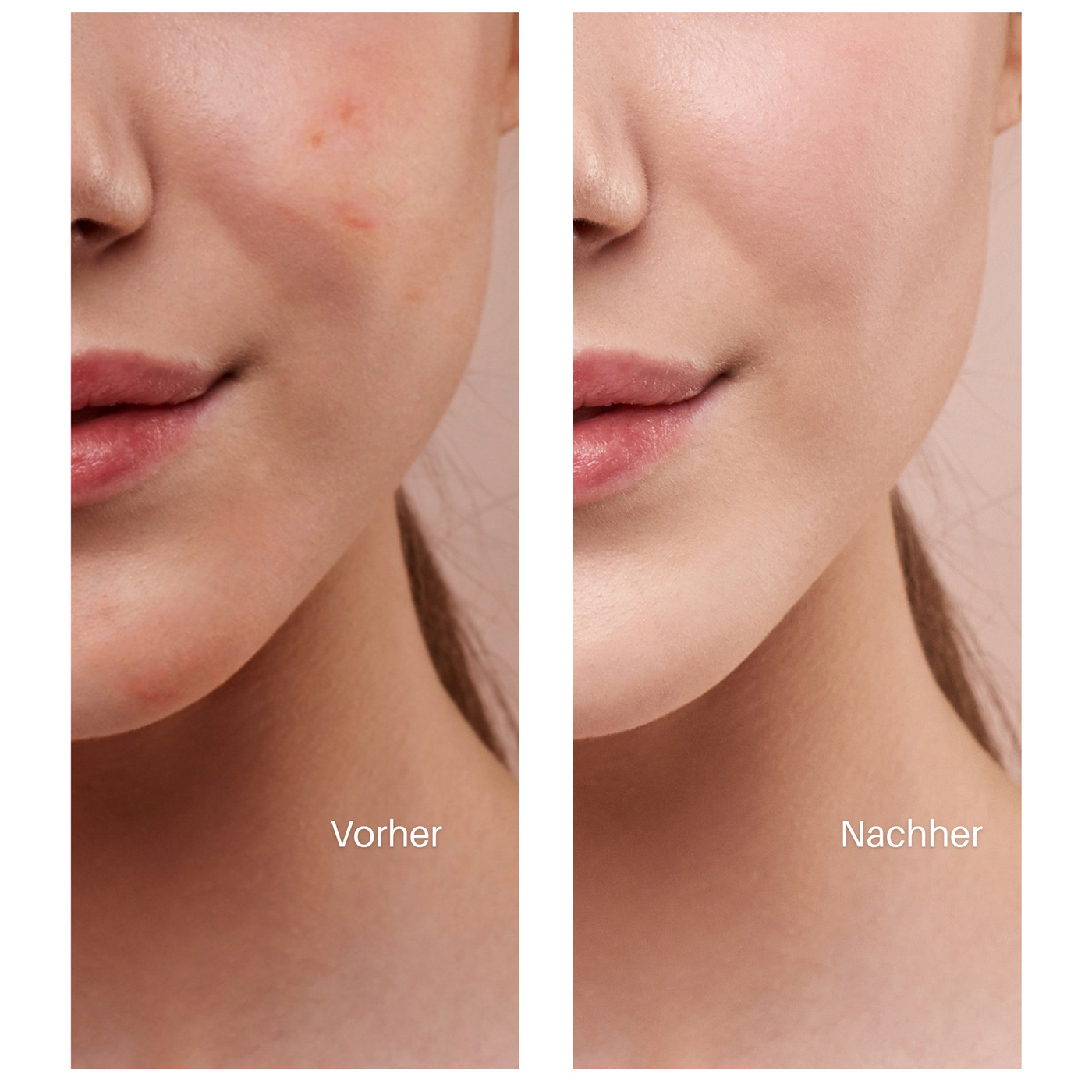 DreamSkin | Luxe Huid Nachtmasker