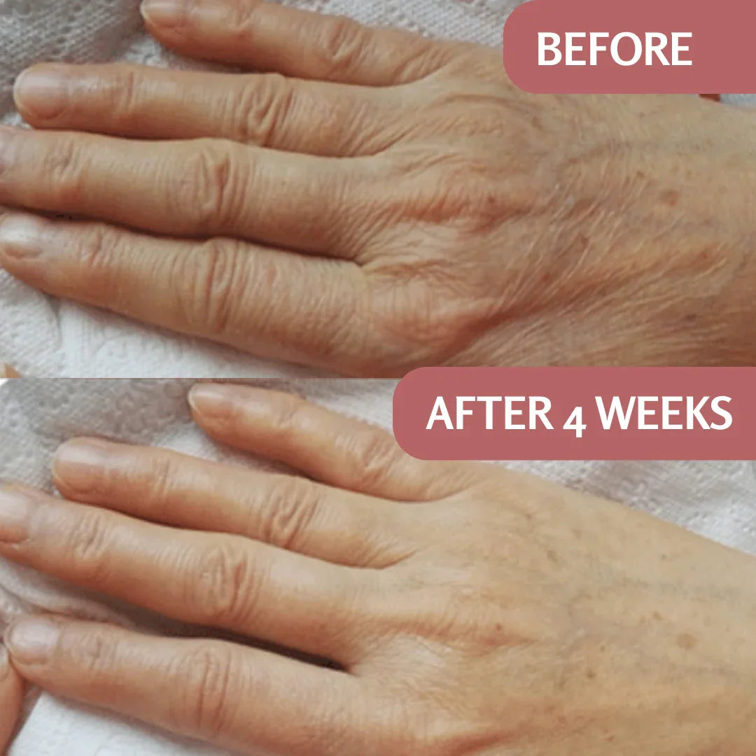 PureRise | Luxe Huidverjonging