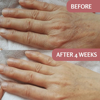 PureRise | Luxe Huidverjonging