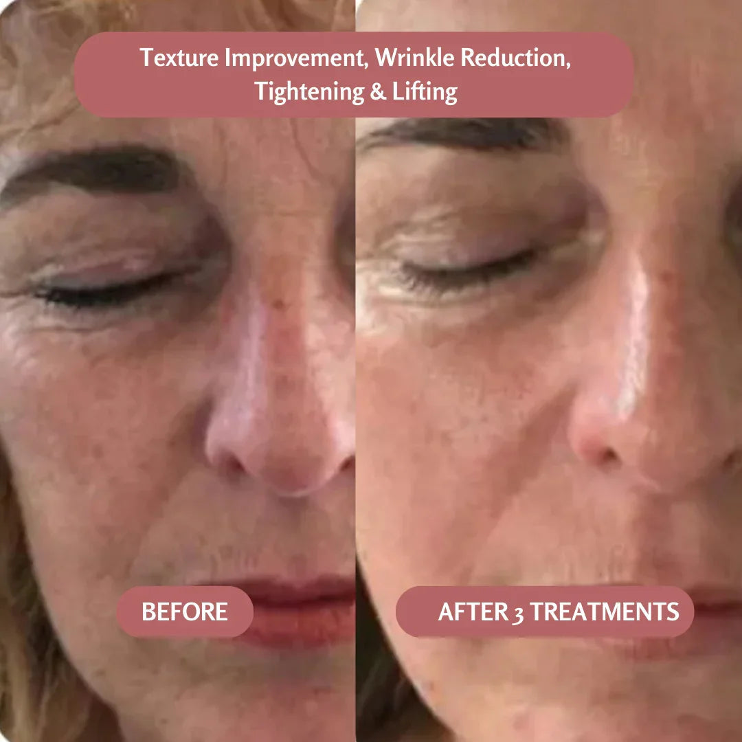 PureRise | Luxe Huidverjonging